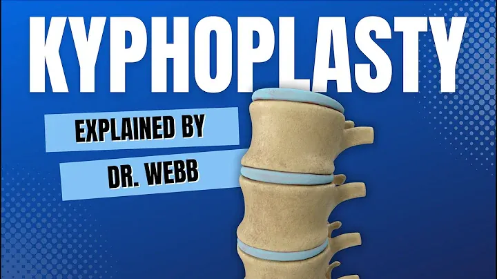 Kyphoplasty explained by Dr. Webb
